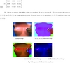 Finger Tracking for Breast Palpation Quantification With Stereo Color Cameras