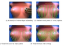 Finger Tracking for Breast Palpation Quantification With Stereo Color Cameras